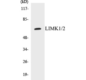 Western Blot - LIMK1 + 2 Cell Based ELISA Kit (CB5416) - Antibodies.com