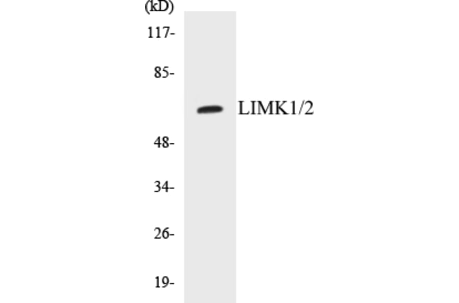 Western Blot - LIMK1 + 2 Cell Based ELISA Kit (CB5416) - Antibodies.com