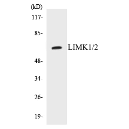 Western Blot - LIMK1 + 2 Cell Based ELISA Kit (CB5416) - Antibodies.com