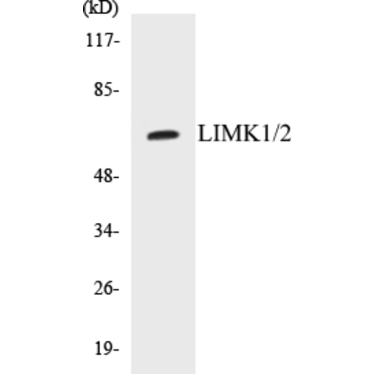 Western Blot - LIMK1 + 2 Cell Based ELISA Kit (CB5416) - Antibodies.com