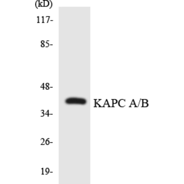 Western Blot - KAPCA + B Cell Based ELISA Kit (CB5847) - Antibodies.com
