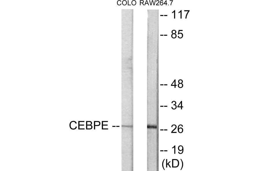 Western Blot - CEBPD + E Cell Based ELISA Kit (CB5901) - Antibodies.com