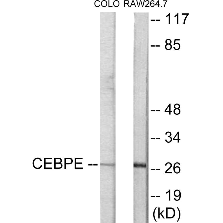 Western Blot - CEBPD + E Cell Based ELISA Kit (CB5901) - Antibodies.com