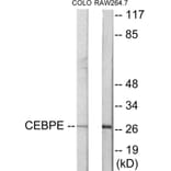 Western Blot - CEBPD + E Cell Based ELISA Kit (CB5901) - Antibodies.com