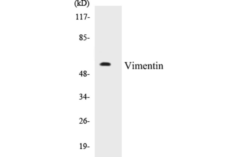 Western Blot - Vimentin Cell Based ELISA Kit (CB5724) - Antibodies.com