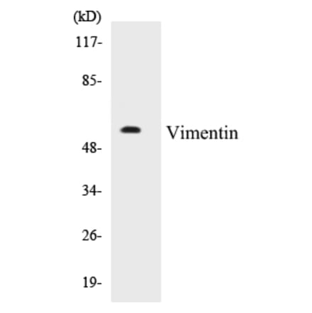 Western Blot - Vimentin Cell Based ELISA Kit (CB5724) - Antibodies.com