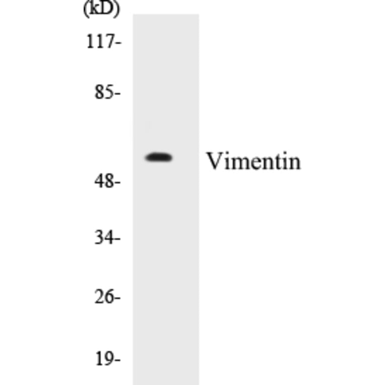 Western Blot - Vimentin Cell Based ELISA Kit (CB5724) - Antibodies.com