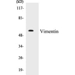 Western Blot - Vimentin Cell Based ELISA Kit (CB5724) - Antibodies.com