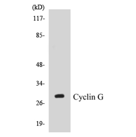 Western Blot - Cyclin G Cell Based ELISA Kit (CB5192) - Antibodies.com