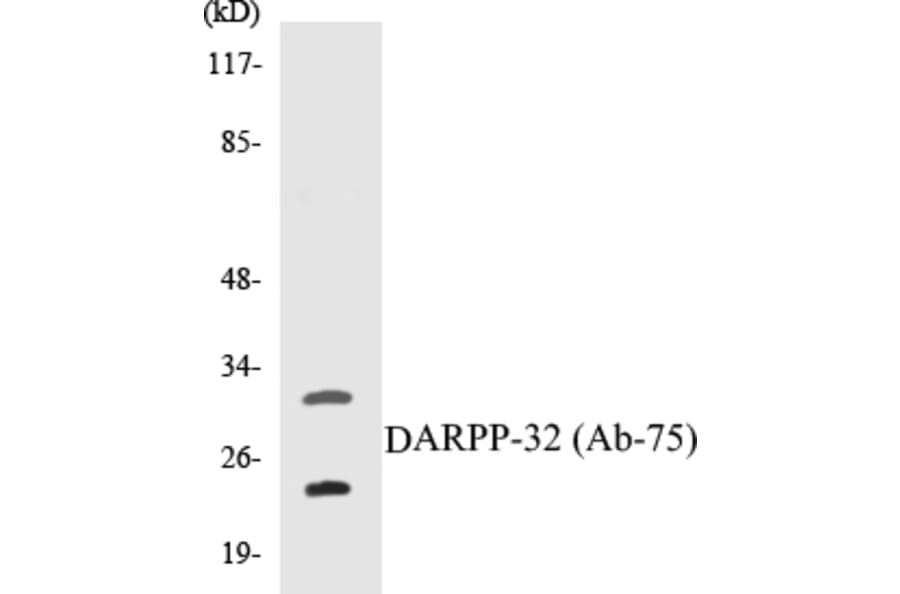 Western Blot - DARPP-32 Cell Based ELISA Kit (CB5199) - Antibodies.com