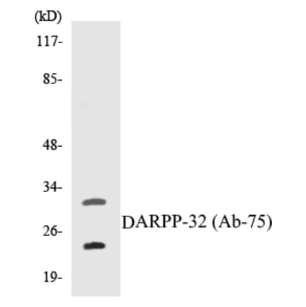 Western Blot - DARPP-32 Cell Based ELISA Kit (CB5199) - Antibodies.com