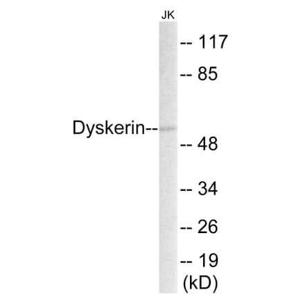 Western Blot - Dyskerin Cell Based ELISA Kit (CB5795) - Antibodies.com