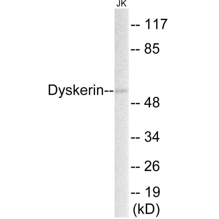 Western Blot - Dyskerin Cell Based ELISA Kit (CB5795) - Antibodies.com