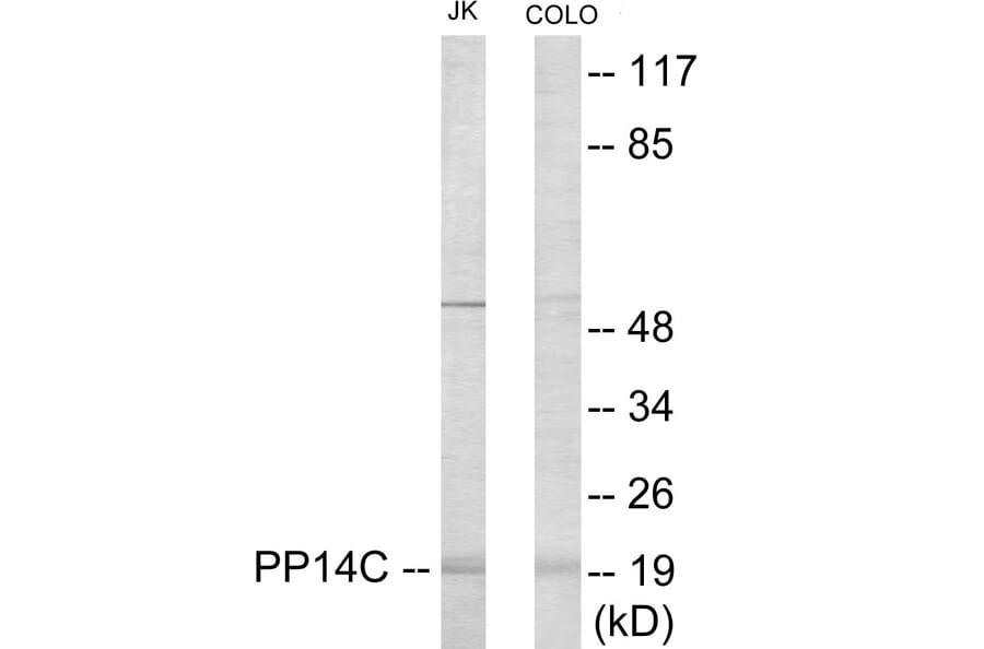 Western Blot - PPP1R14C Cell Based ELISA Kit (CB6086) - Antibodies.com