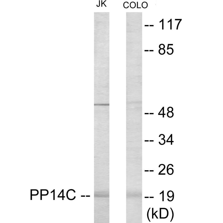 Western Blot - PPP1R14C Cell Based ELISA Kit (CB6086) - Antibodies.com