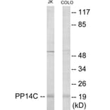 Western Blot - PPP1R14C Cell Based ELISA Kit (CB6086) - Antibodies.com
