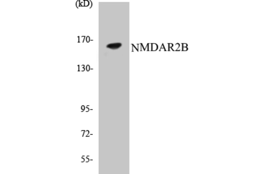 Western Blot - NMDAR2B Cell Based ELISA Kit (CB5493) - Antibodies.com