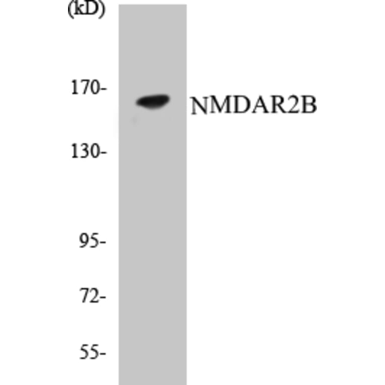 Western Blot - NMDAR2B Cell Based ELISA Kit (CB5493) - Antibodies.com