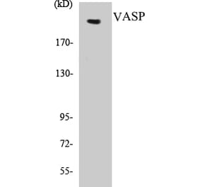 Western Blot - Tuberin Cell Based ELISA Kit (CB5707) - Antibodies.com