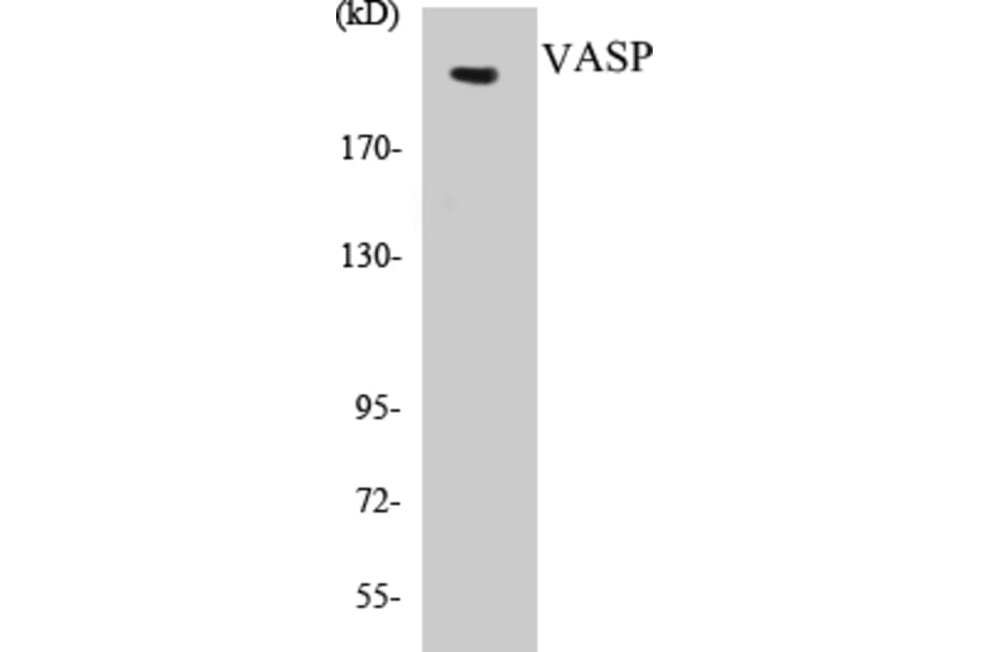 Western Blot - Tuberin Cell Based ELISA Kit (CB5707) - Antibodies.com