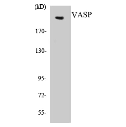Western Blot - Tuberin Cell Based ELISA Kit (CB5707) - Antibodies.com