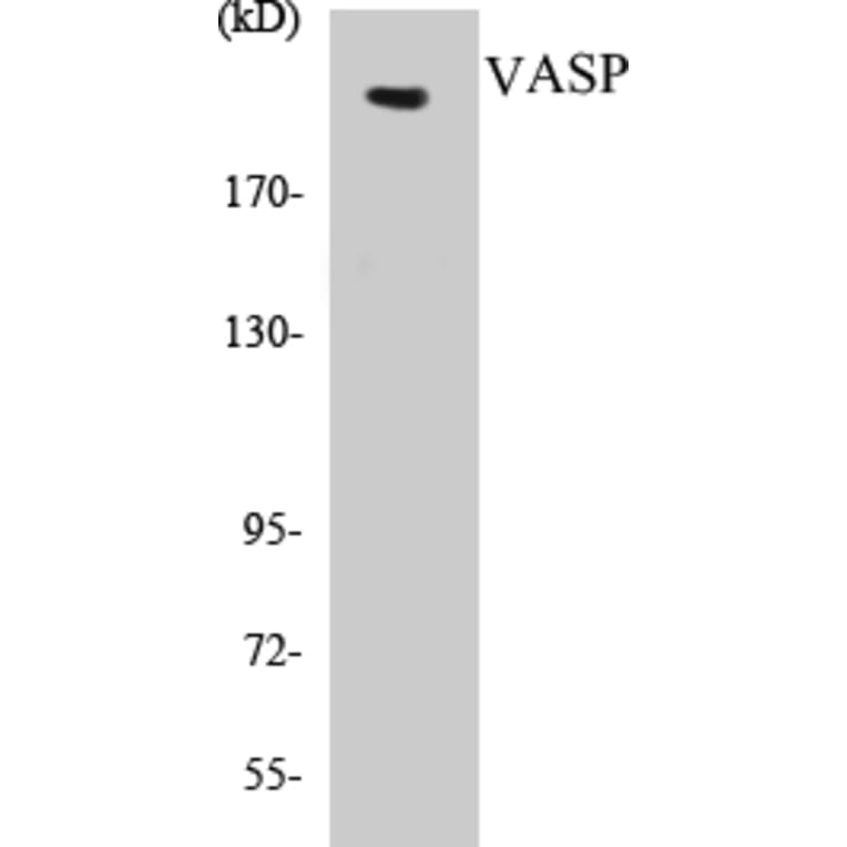 Western Blot - Tuberin Cell Based ELISA Kit (CB5707) - Antibodies.com