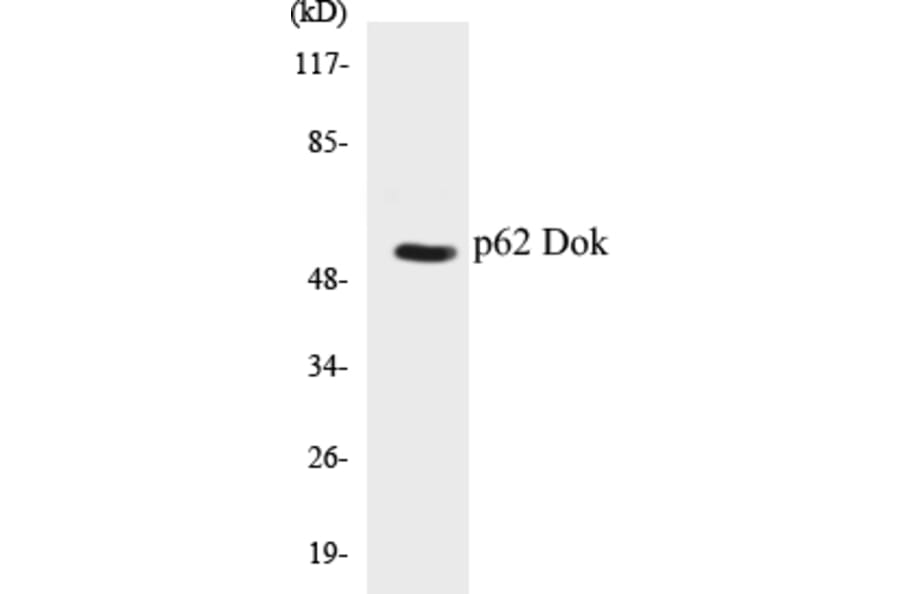 Western Blot - p62 Dok Cell Based ELISA Kit (CB5521) - Antibodies.com