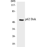 Western Blot - p62 Dok Cell Based ELISA Kit (CB5521) - Antibodies.com