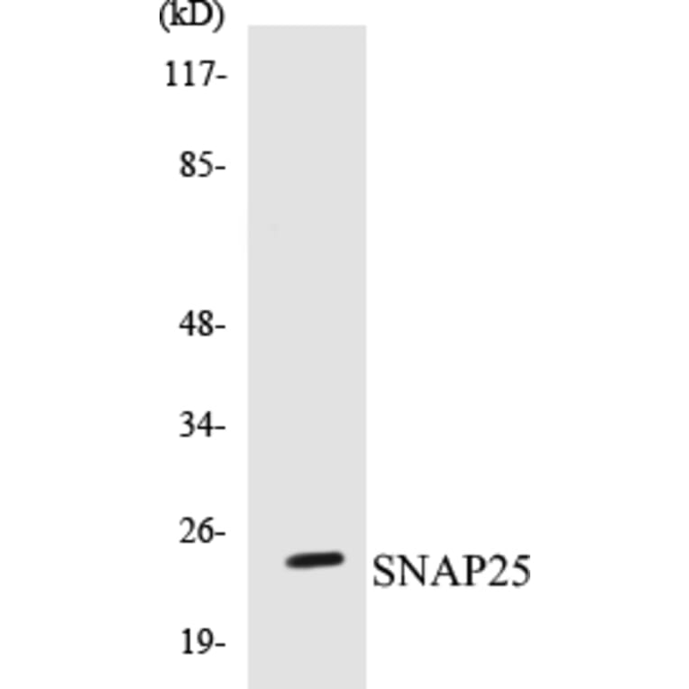 Western Blot - SNAP25 Cell Based ELISA Kit (CB5644) - Antibodies.com