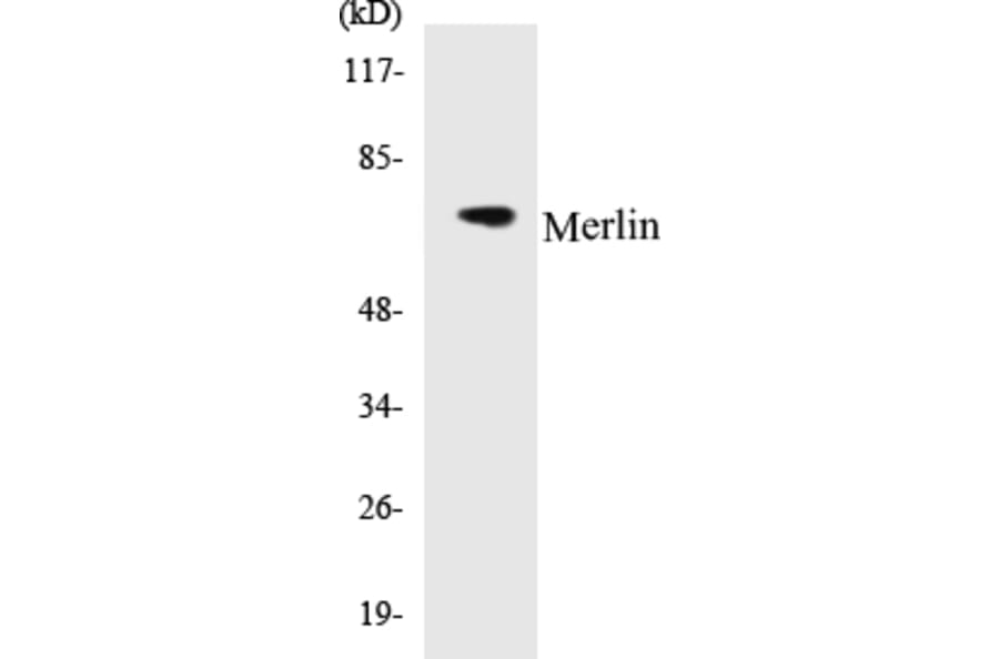 Western Blot - Merlin Cell Based ELISA Kit (CB5443) - Antibodies.com