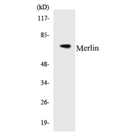 Western Blot - Merlin Cell Based ELISA Kit (CB5443) - Antibodies.com