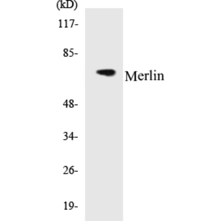 Western Blot - Merlin Cell Based ELISA Kit (CB5443) - Antibodies.com