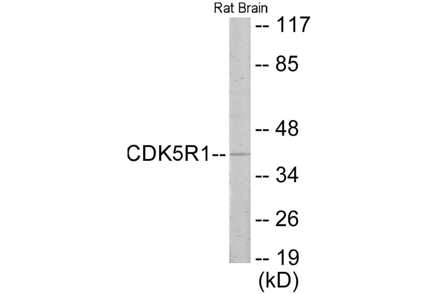 Western Blot - CDK5R1 Cell Based ELISA Kit (CB6013) - Antibodies.com