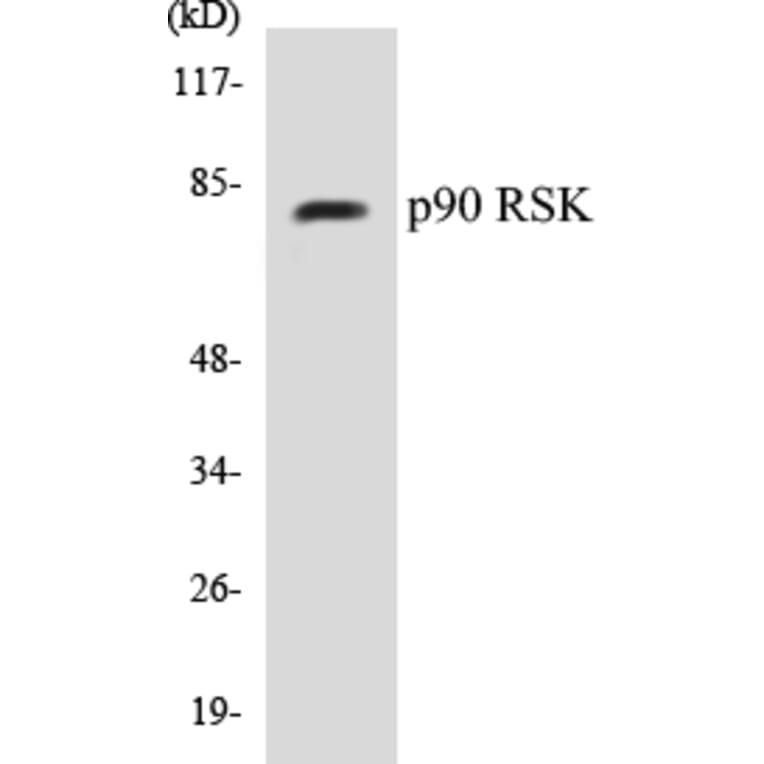 Western Blot - p90RSK Cell Based ELISA Kit (CB5526) - Antibodies.com