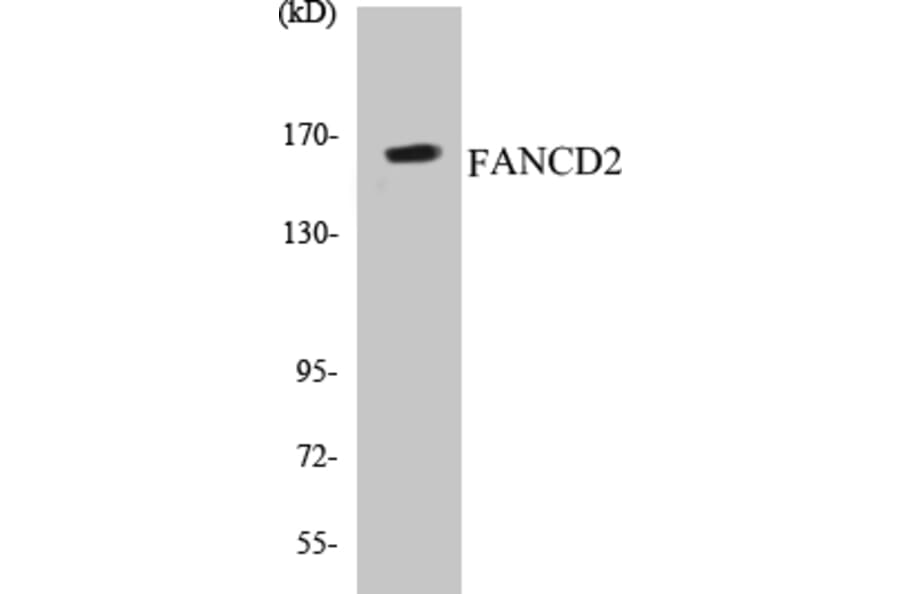 Western Blot - FANCD2 Cell Based ELISA Kit (CB5256) - Antibodies.com