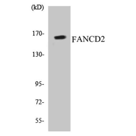 Western Blot - FANCD2 Cell Based ELISA Kit (CB5256) - Antibodies.com