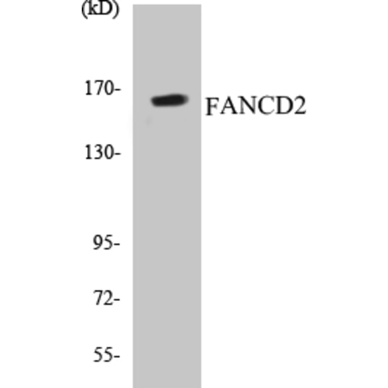 Western Blot - FANCD2 Cell Based ELISA Kit (CB5256) - Antibodies.com
