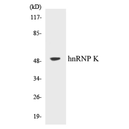 Western Blot - hnRNPK Cell Based ELISA Kit (CB5339) - Antibodies.com