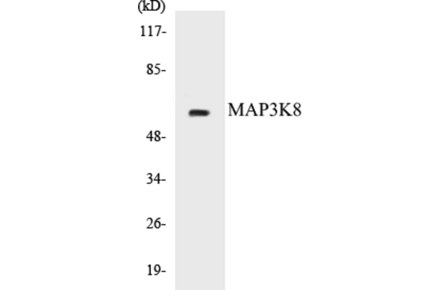 Western Blot - MAP3K8 Cell Based ELISA Kit (CB5426) - Antibodies.com
