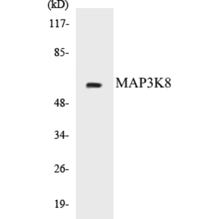 Western Blot - MAP3K8 Cell Based ELISA Kit (CB5426) - Antibodies.com