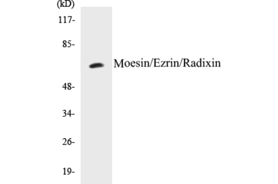 Western Blot - Moesin Cell Based ELISA Kit (CB5469) - Antibodies.com