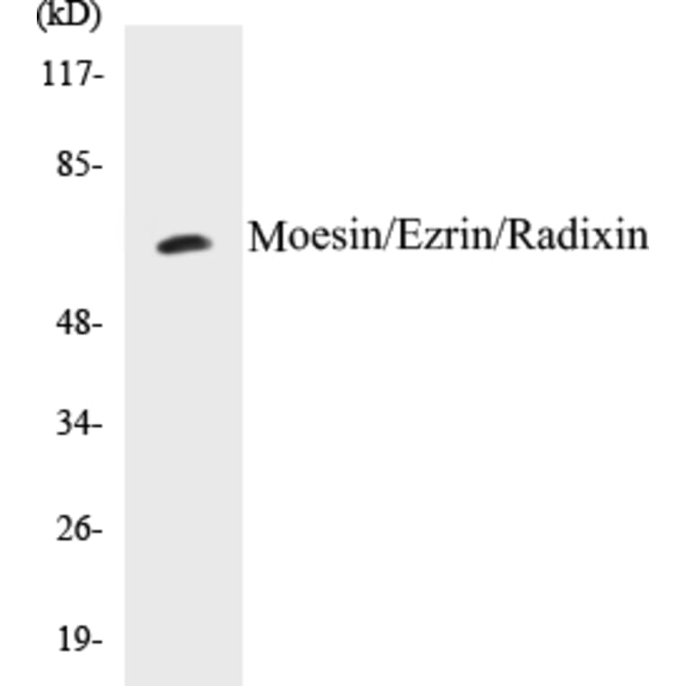 Western Blot - Moesin Cell Based ELISA Kit (CB5469) - Antibodies.com