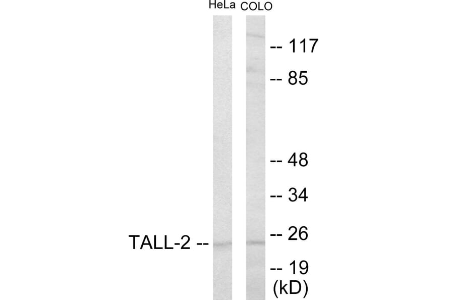 Western Blot - TALL-2 Cell Based ELISA Kit (CB5807) - Antibodies.com