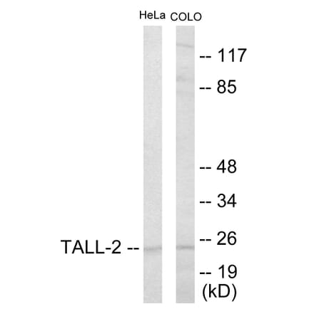 Western Blot - TALL-2 Cell Based ELISA Kit (CB5807) - Antibodies.com