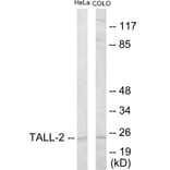 Western Blot - TALL-2 Cell Based ELISA Kit (CB5807) - Antibodies.com