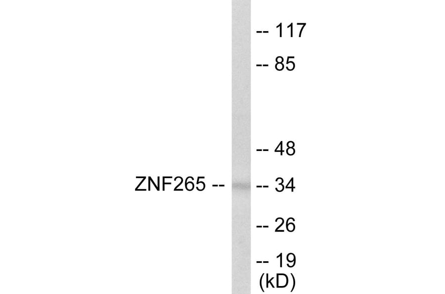 Western Blot - ZNF265 Cell Based ELISA Kit (CB5817) - Antibodies.com