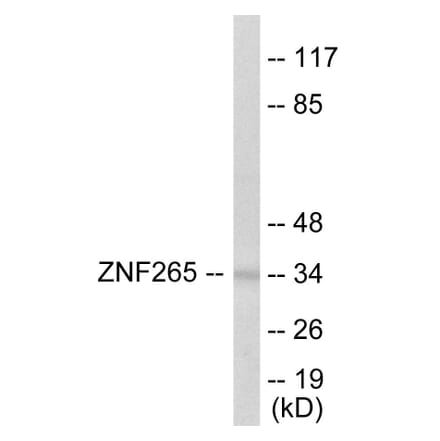 Western Blot - ZNF265 Cell Based ELISA Kit (CB5817) - Antibodies.com