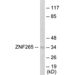 Western Blot - ZNF265 Cell Based ELISA Kit (CB5817) - Antibodies.com