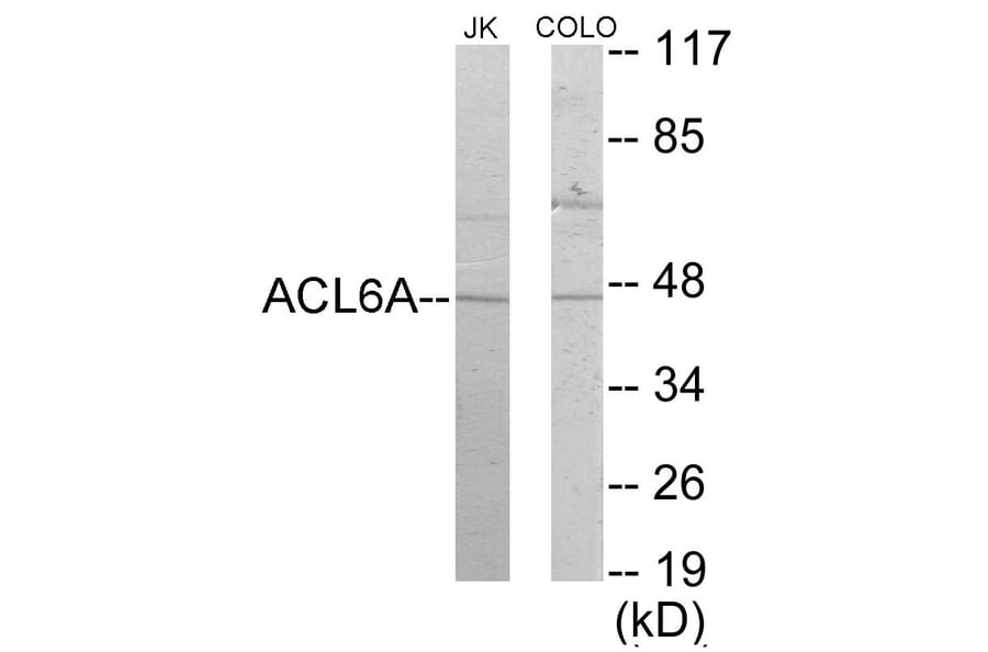 Western Blot - ACTL6A Cell Based ELISA Kit (CB5828) - Antibodies.com
