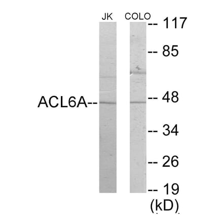 Western Blot - ACTL6A Cell Based ELISA Kit (CB5828) - Antibodies.com